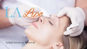 Woman receiving Actinic Keratosis Removal Treatment Bow