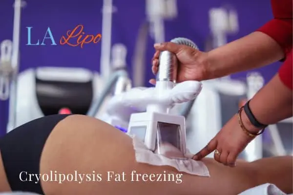 women getting fat freezing Bow