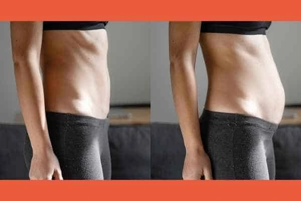 LA-EMS Body Sculpting results Bow