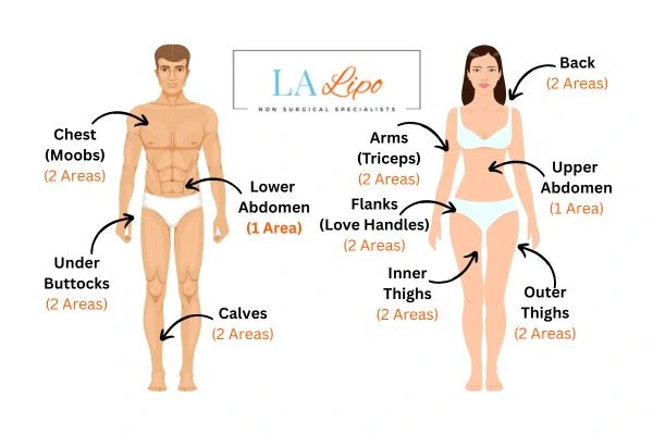 LA LIPO Cryolipolysis Areas Bow