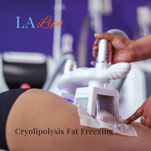fat freezing - Cryolipolysis Bow