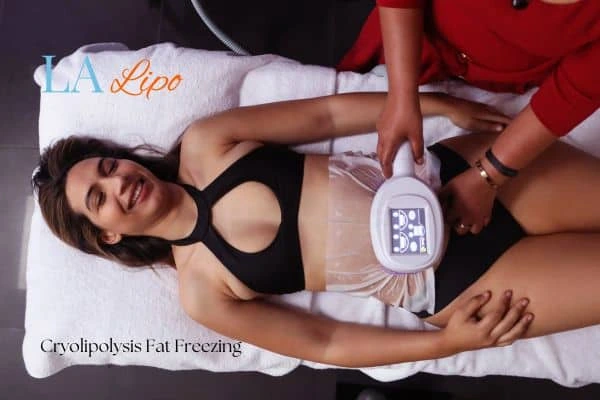 woman getting cryolipolysis Bow