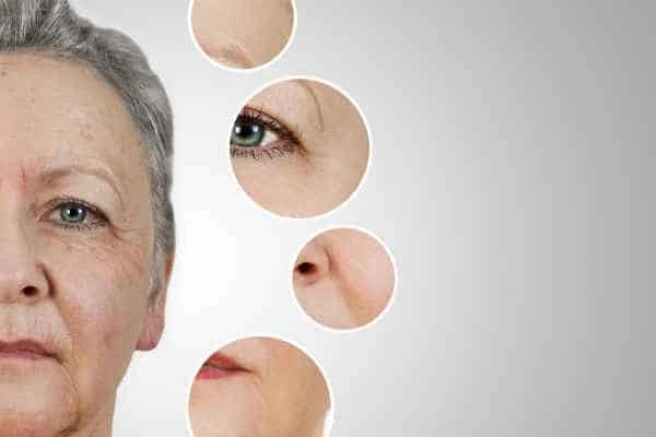 HIFU Facelift Bow from LA LIPO