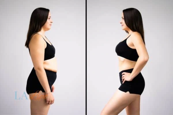 Picture of womans before and after using LA-EMS body sculpting to improve her core strength Bow