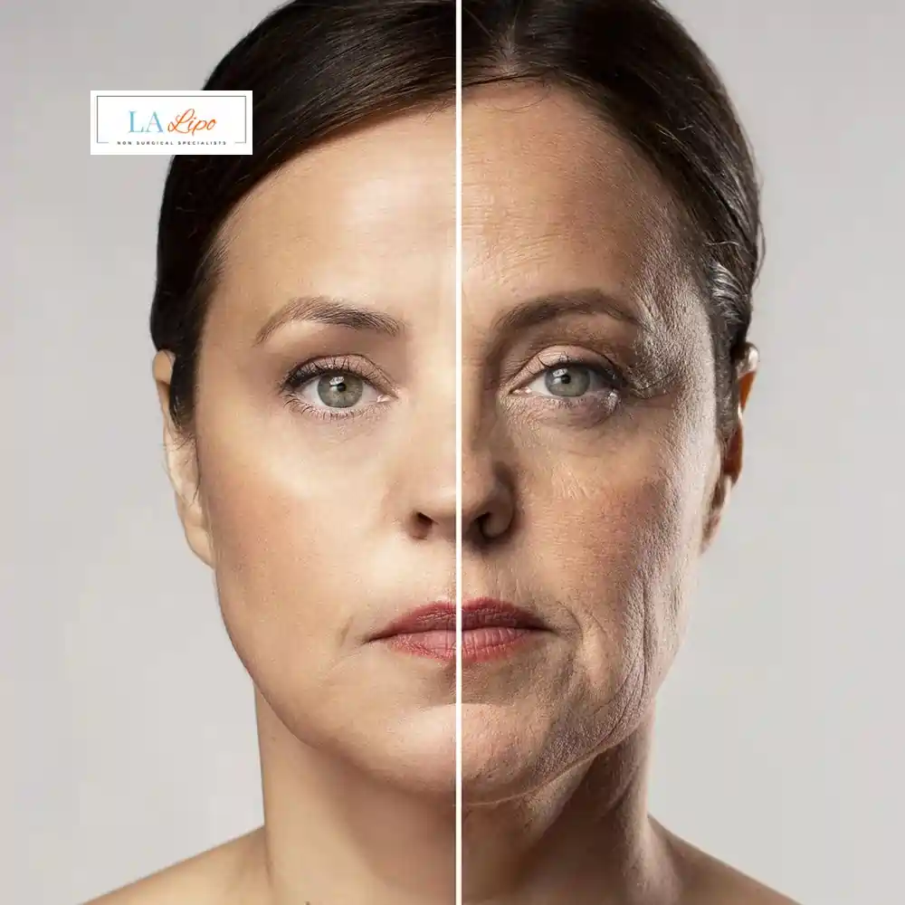 How Can You Tell If Non-Surgical Skin Tightening Is Right for You Bow?