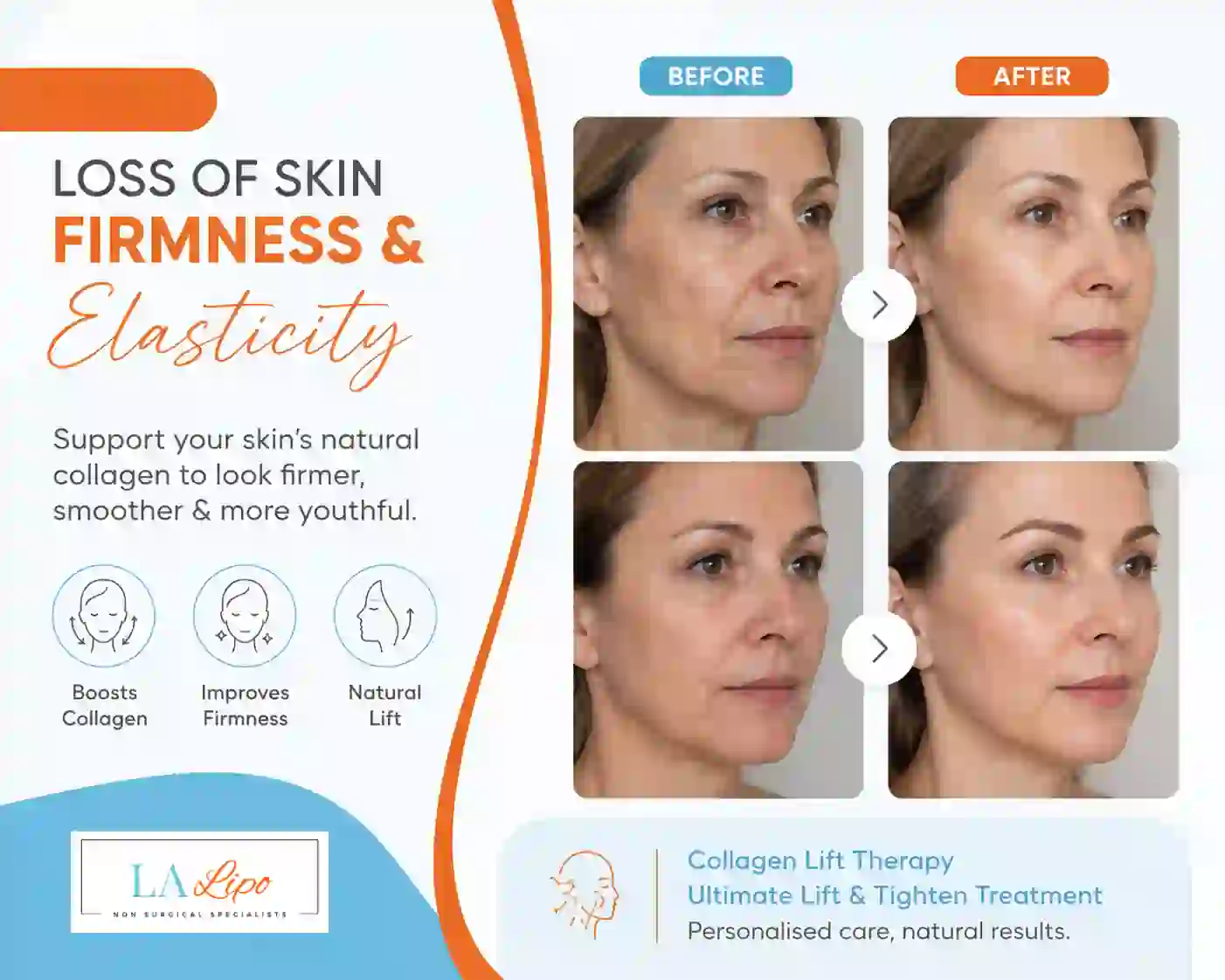 Sign #7: Loss of Skin Firmness and Elasticity Bow